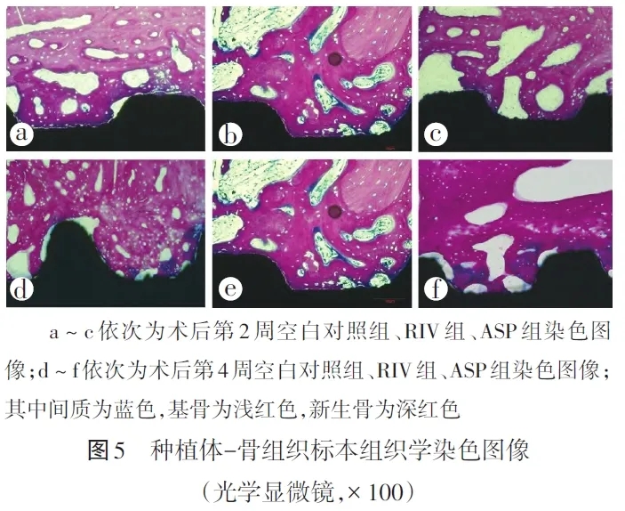 【文章薦讀】利伐沙班對(duì)種植體早期骨結(jié)合影響研究