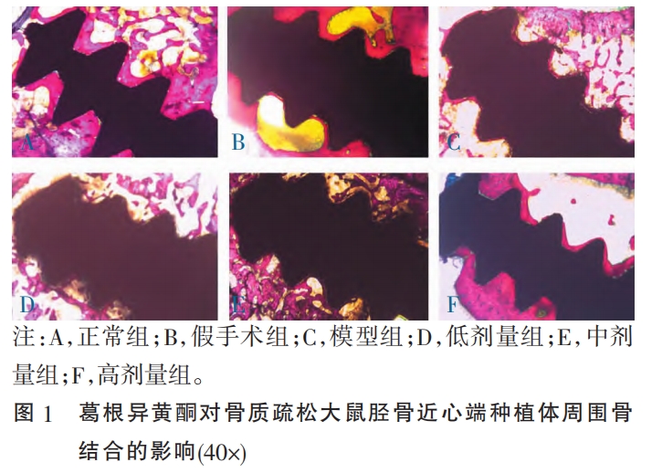 【文章薦讀】葛根異黃酮對骨質疏松狀態下種植體周圍骨結合的影響